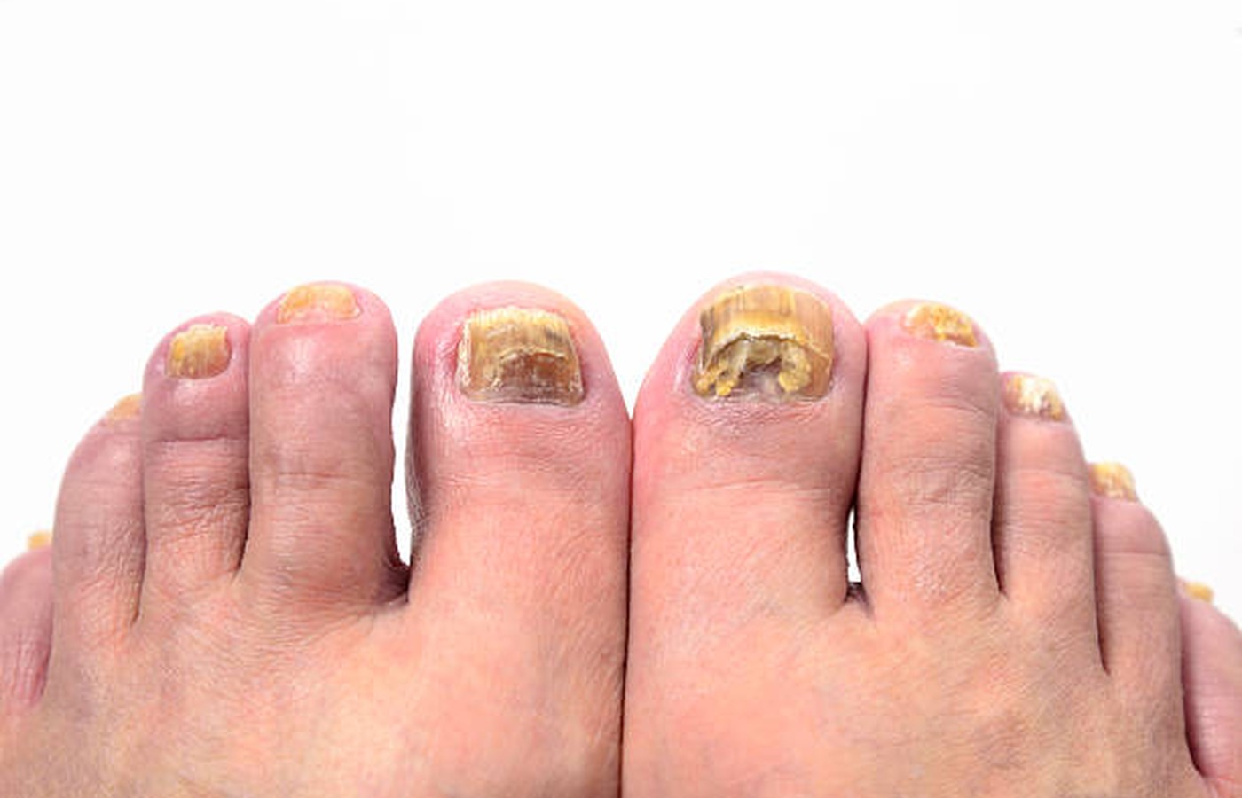Foot & Nail Care category image